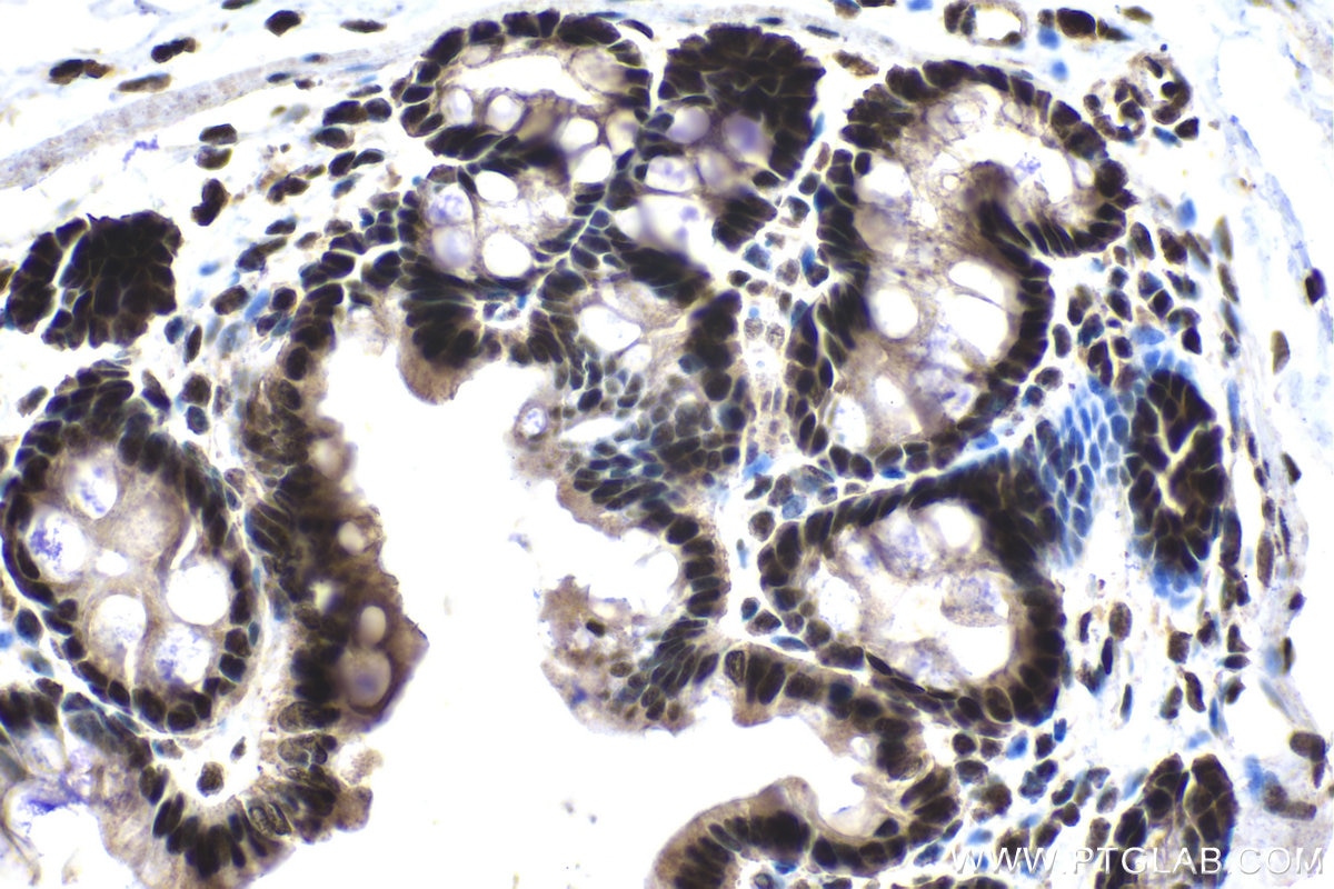 Immunohistochemical analysis of paraffin-embedded rat colon tissue slide using KHC1544 (POLR2C IHC Kit).