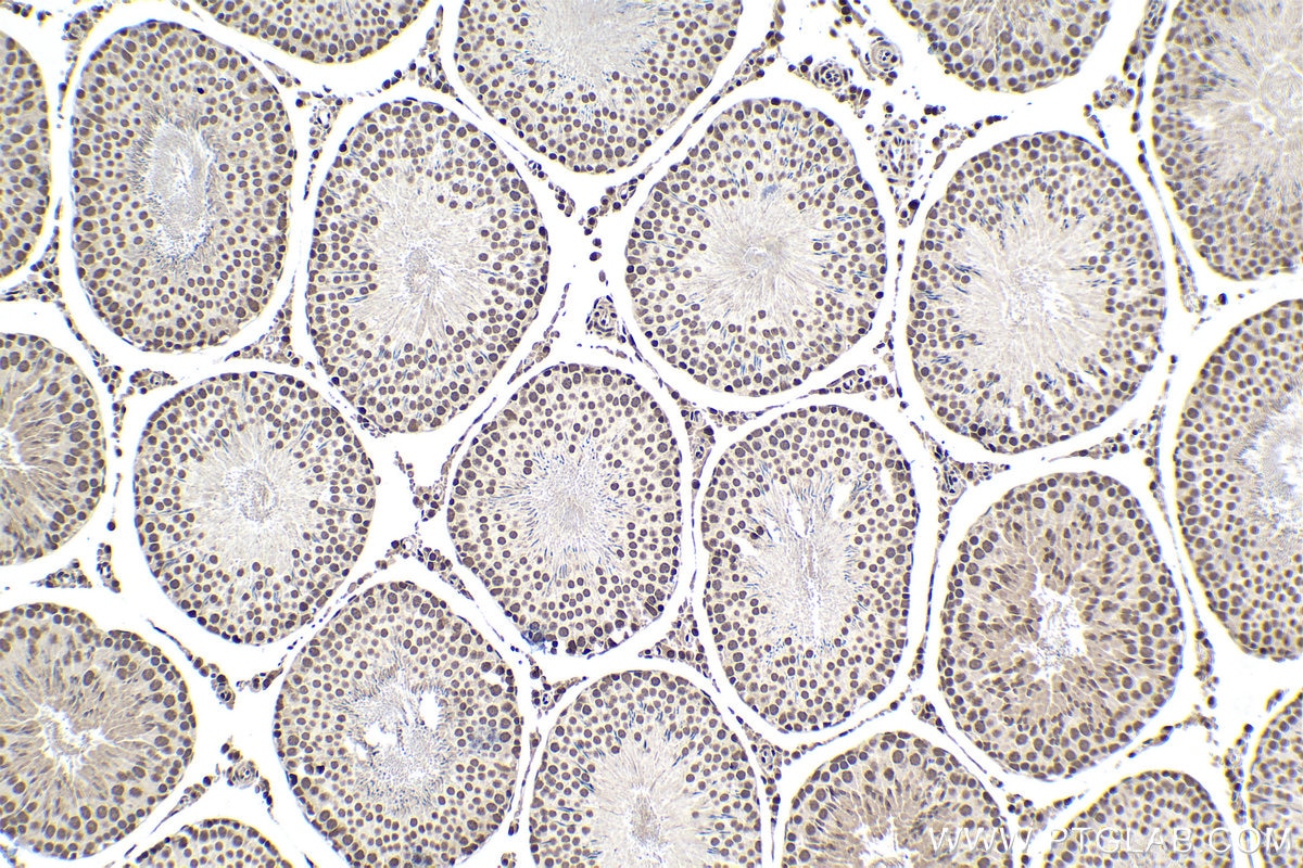 Immunohistochemical analysis of paraffin-embedded rat testis tissue slide using KHC1446 (POLR2D IHC Kit).