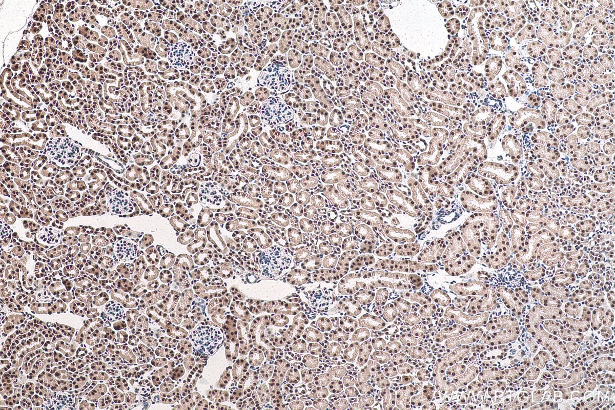 Immunohistochemical analysis of paraffin-embedded mouse kidney tissue slide using KHC0929 (POLR2E/RPB5 IHC Kit).
