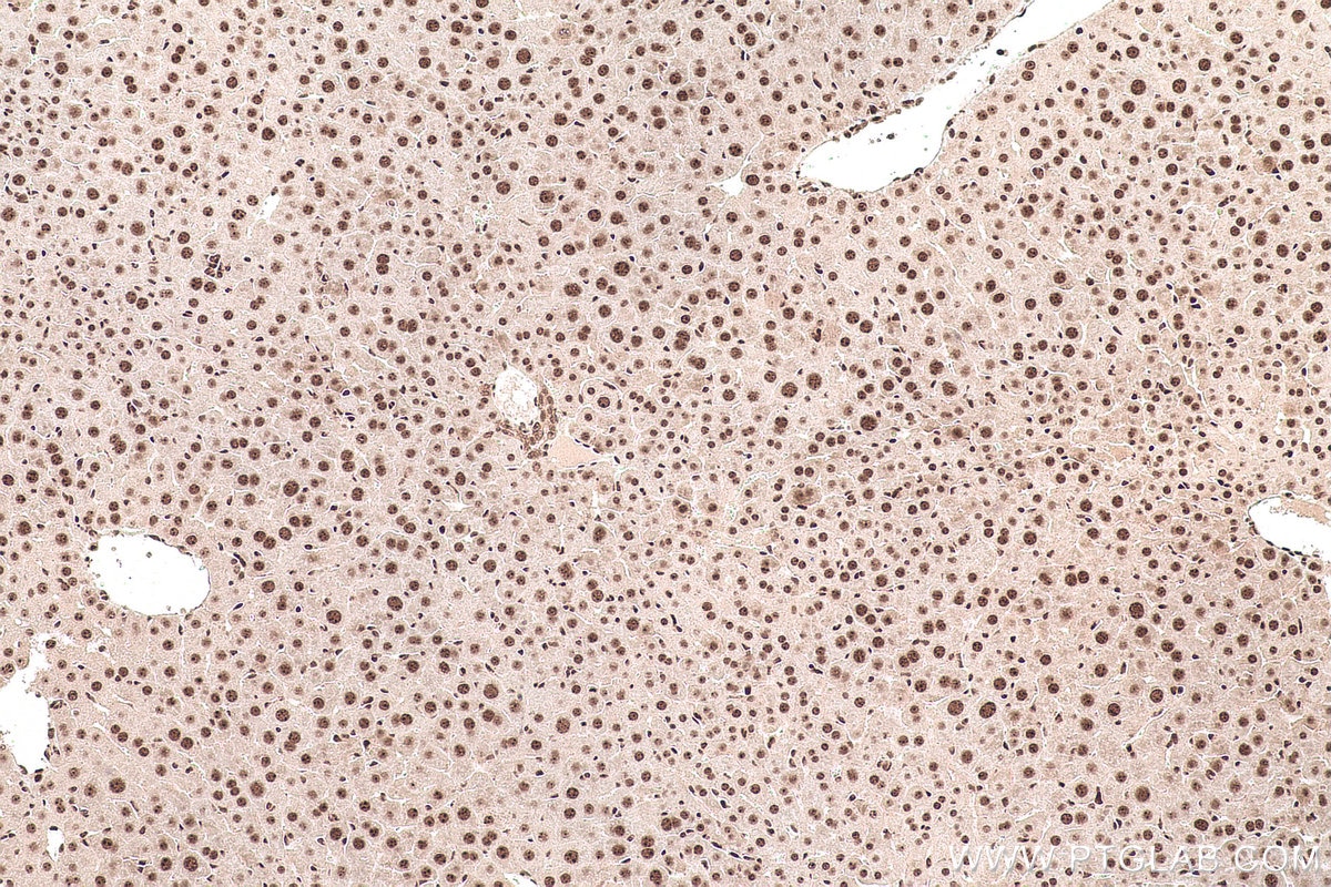 Immunohistochemical analysis of paraffin-embedded mouse liver tissue slide using KHC0929 (POLR2E/RPB5 IHC Kit).