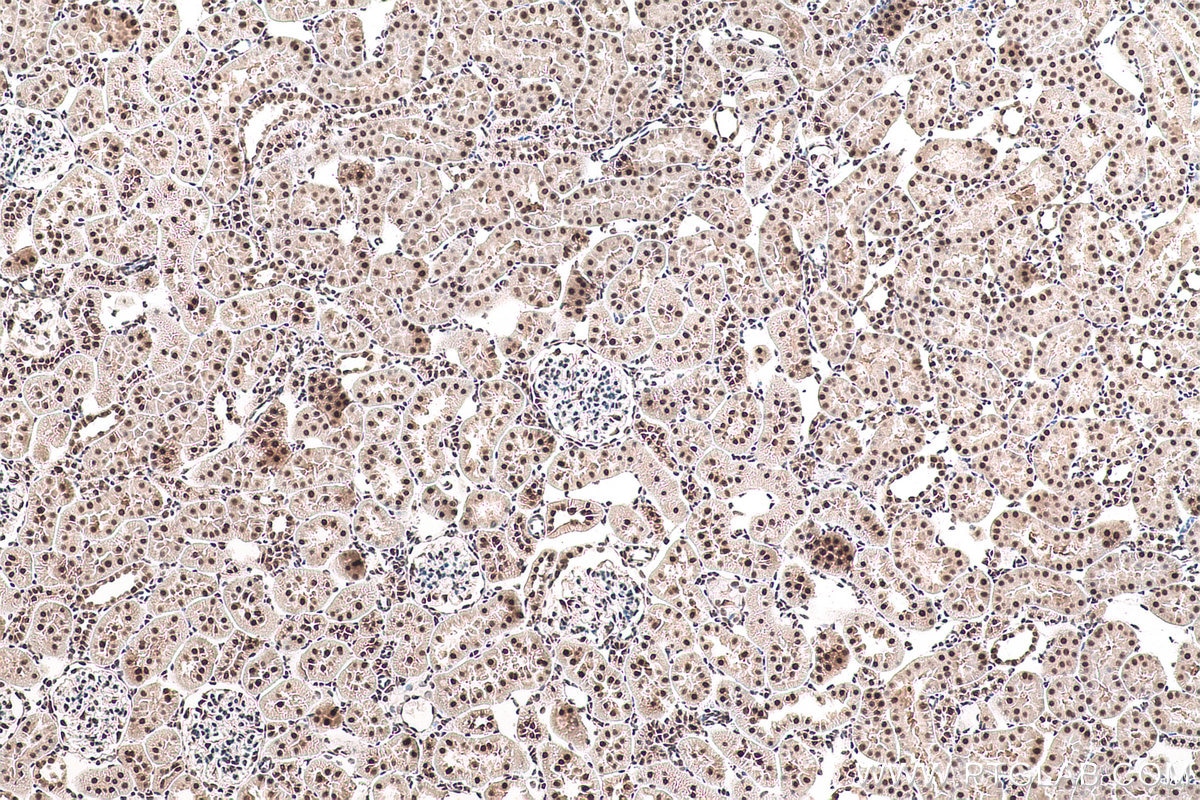 Immunohistochemical analysis of paraffin-embedded rat kidney tissue slide using KHC0929 (POLR2E/RPB5 IHC Kit).