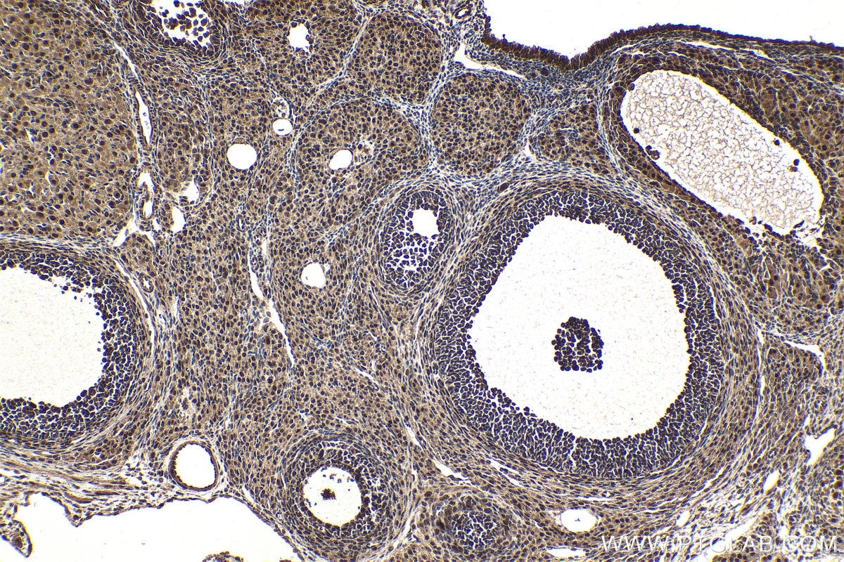 Immunohistochemical analysis of paraffin-embedded rat ovary tissue slide using KHC2071 (POLR3G IHC Kit).