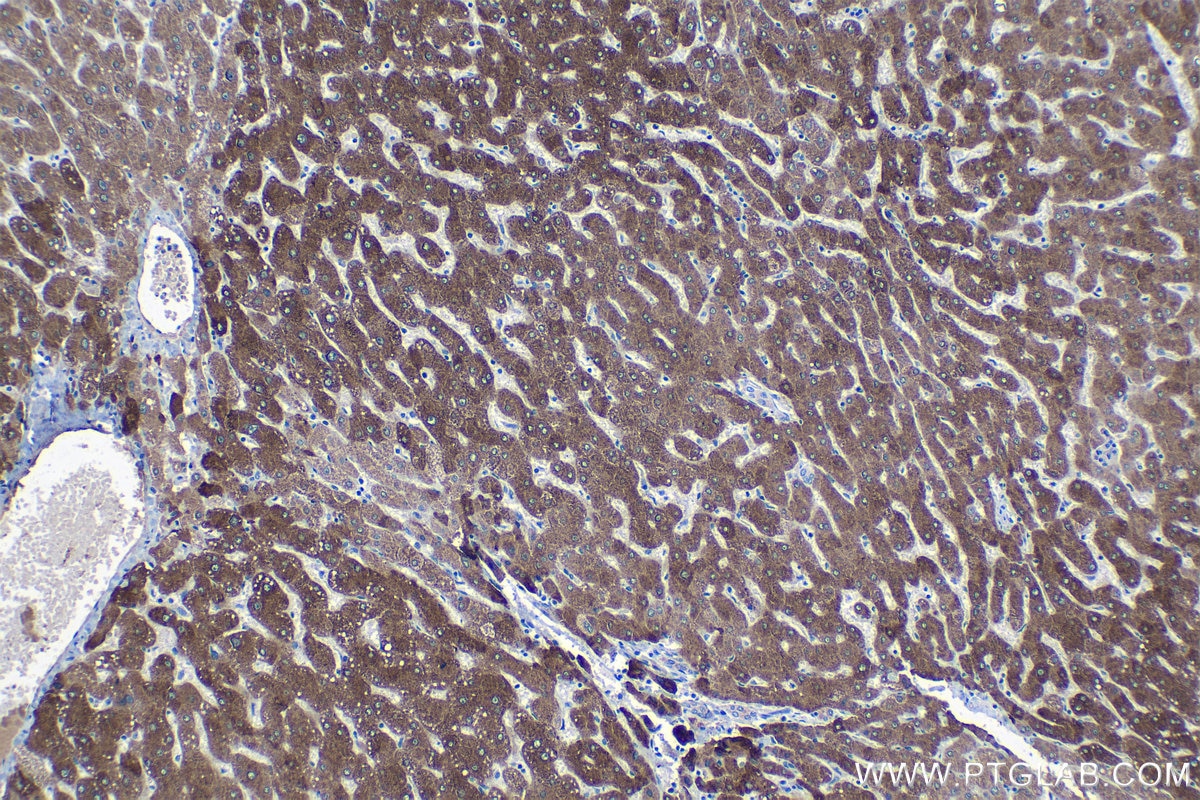 Immunohistochemical analysis of paraffin-embedded human liver tissue slide using KHC1371 (PON1 IHC Kit).