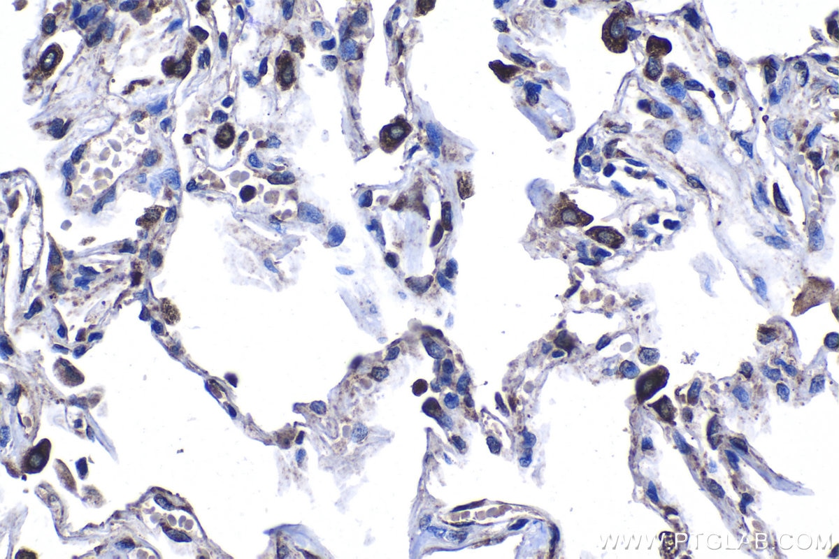 Immunohistochemical analysis of paraffin-embedded human lung tissue slide using KHC1254 (PON2 IHC Kit).