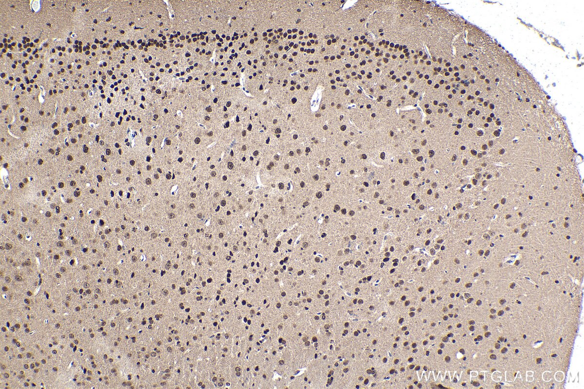 Immunohistochemical analysis of paraffin-embedded mouse brain tissue slide using KHC1549 (POU3F2/BRN2 IHC Kit).