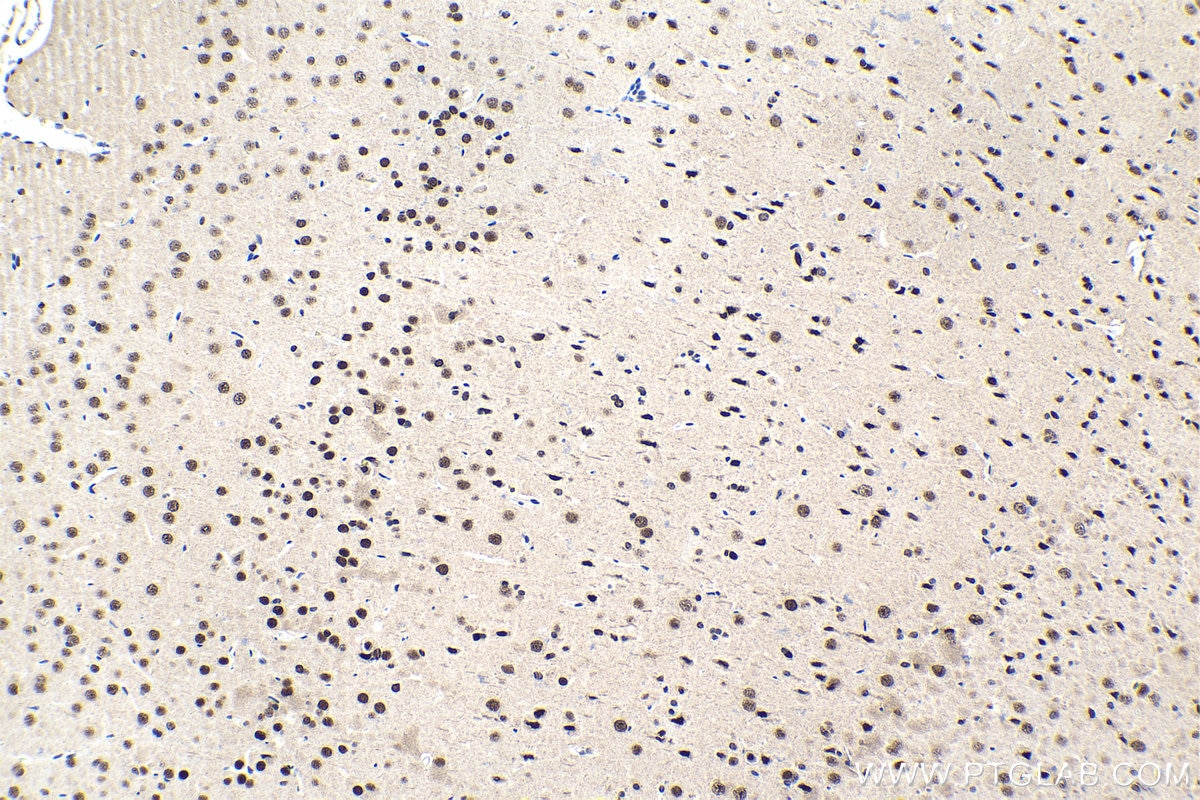 Immunohistochemical analysis of paraffin-embedded rat brain tissue slide using KHC1549 (POU3F2/BRN2 IHC Kit).