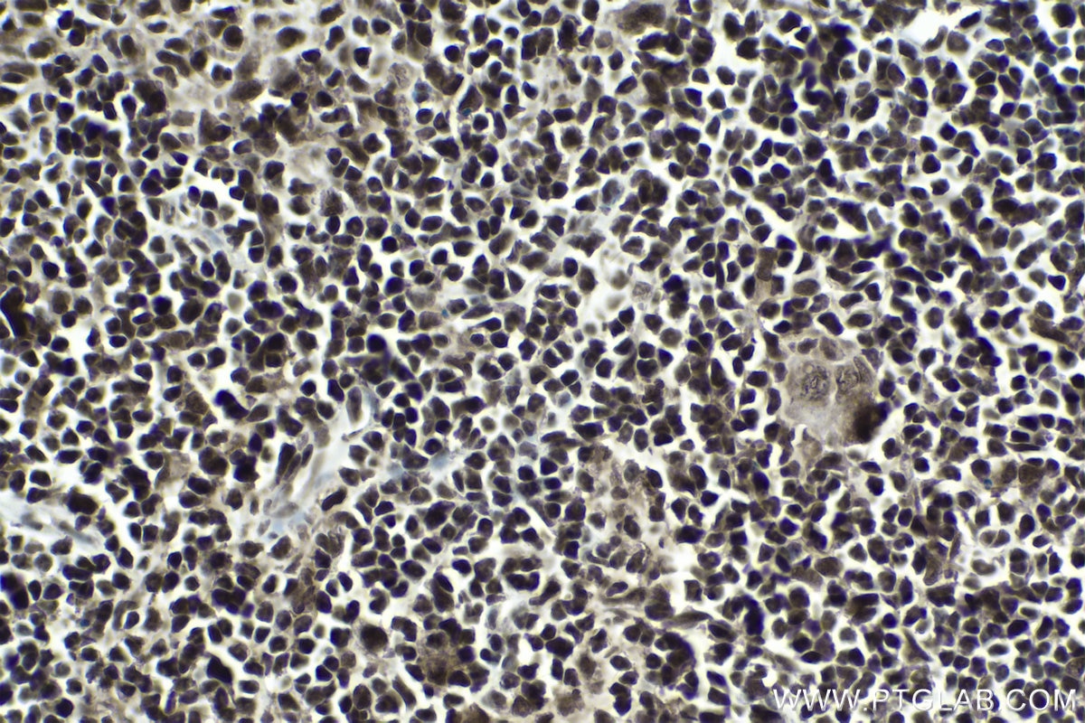 Immunohistochemical analysis of paraffin-embedded rat thymus tissue slide using KHC1750 (POU4F3 IHC Kit).