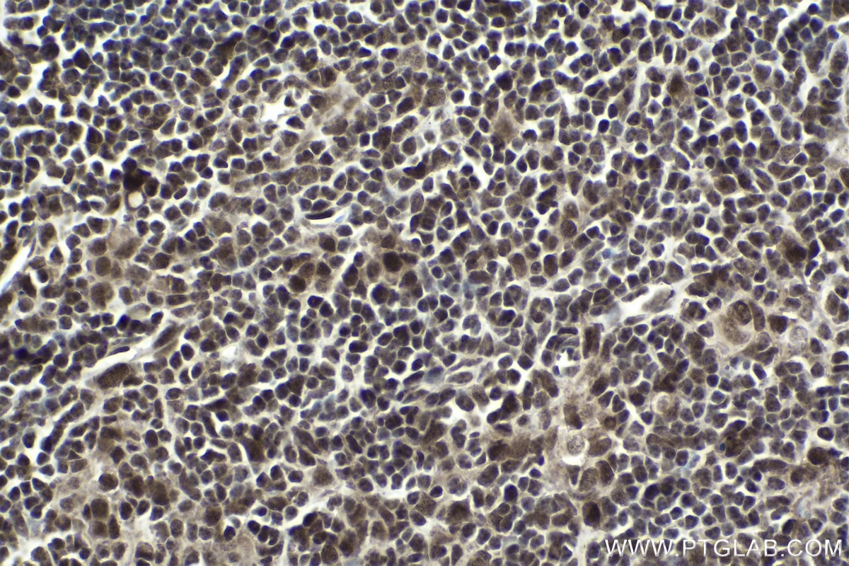 Immunohistochemical analysis of paraffin-embedded mouse thymus tissue slide using KHC1750 (POU4F3 IHC Kit).