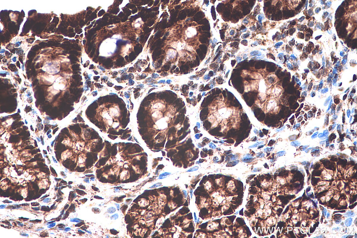 Immunohistochemical analysis of paraffin-embedded rat colon tissue slide using KHC0249 (PPARG IHC Kit).