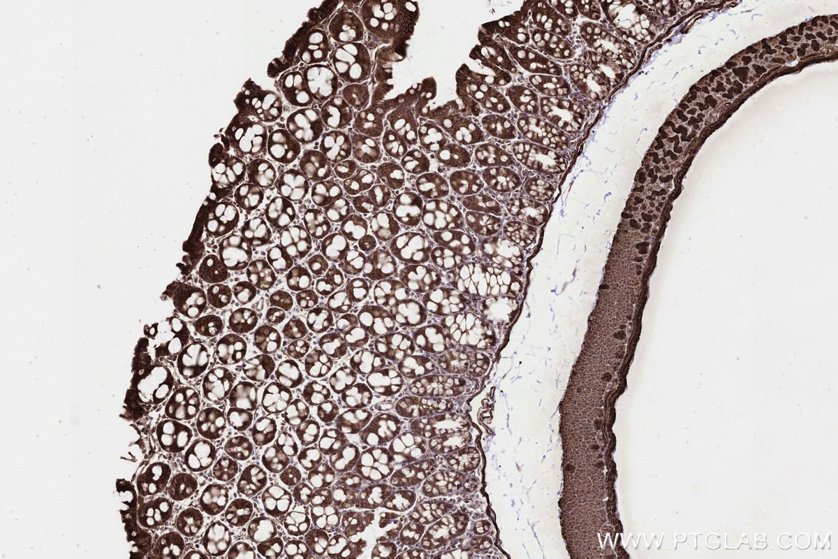 Immunohistochemical analysis of paraffin-embedded mouse colon tissue slide using KHC3247 (PPAT IHC Kit).