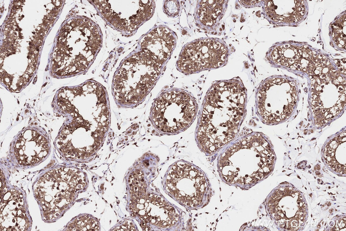 Immunohistochemical analysis of paraffin-embedded human testis tissue slide using KHC3247 (PPAT IHC Kit).