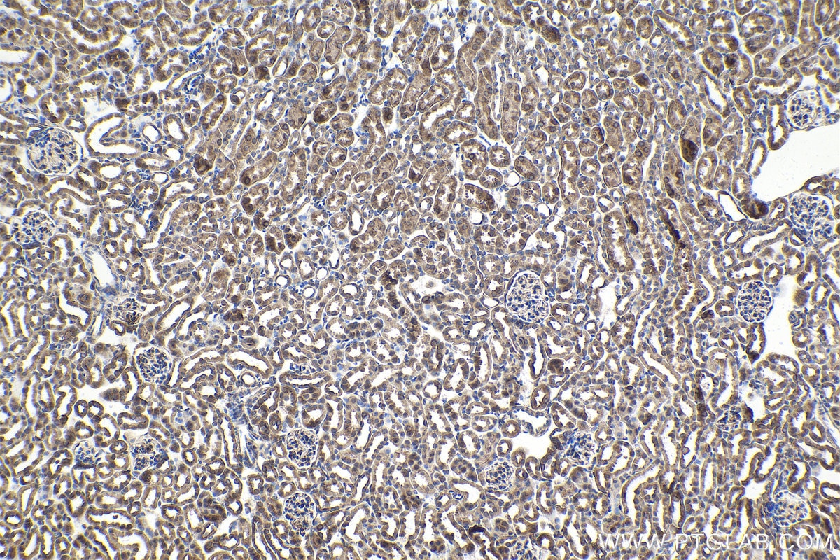 Immunohistochemical analysis of paraffin-embedded mouse kidney tissue slide using KHC1703 (PPFIA1 IHC Kit).