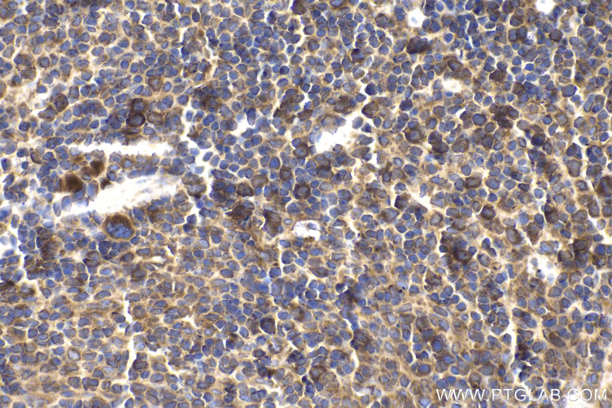 Immunohistochemical analysis of paraffin-embedded mouse spleen tissue slide using KHC1703 (PPFIA1 IHC Kit).
