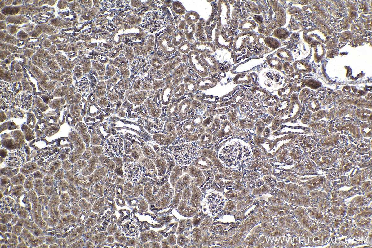 Immunohistochemical analysis of paraffin-embedded rat kidney tissue slide using KHC1703 (PPFIA1 IHC Kit).