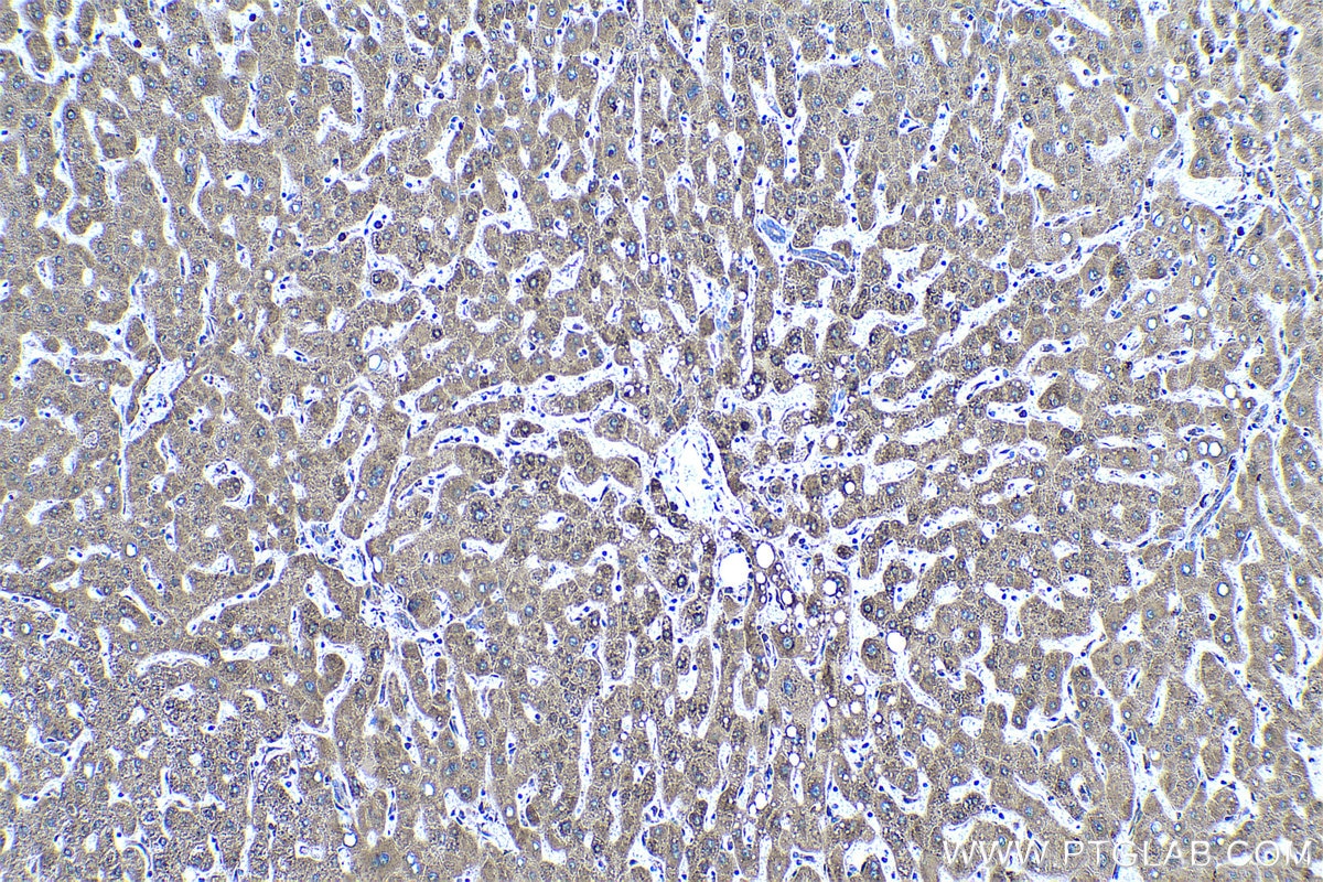 Immunohistochemical analysis of paraffin-embedded human liver tissue slide using KHC0523 (PPIB IHC Kit).