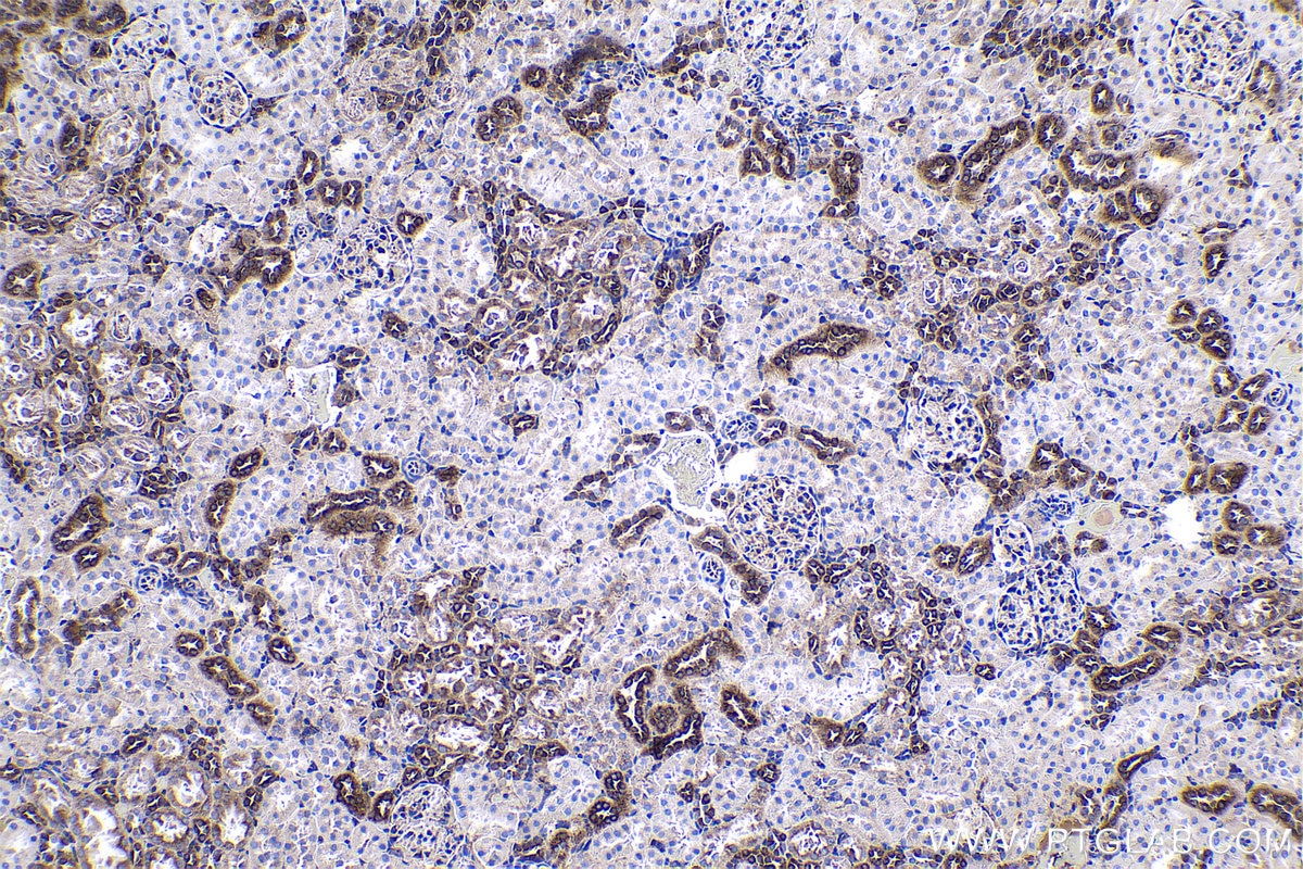 Immunohistochemical analysis of paraffin-embedded rat kidney tissue slide using KHC0523 (PPIB IHC Kit).