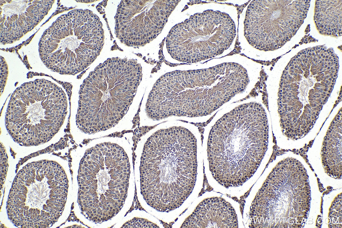 Immunohistochemical analysis of paraffin-embedded rat testis tissue slide using KHC1686 (PPID IHC Kit).