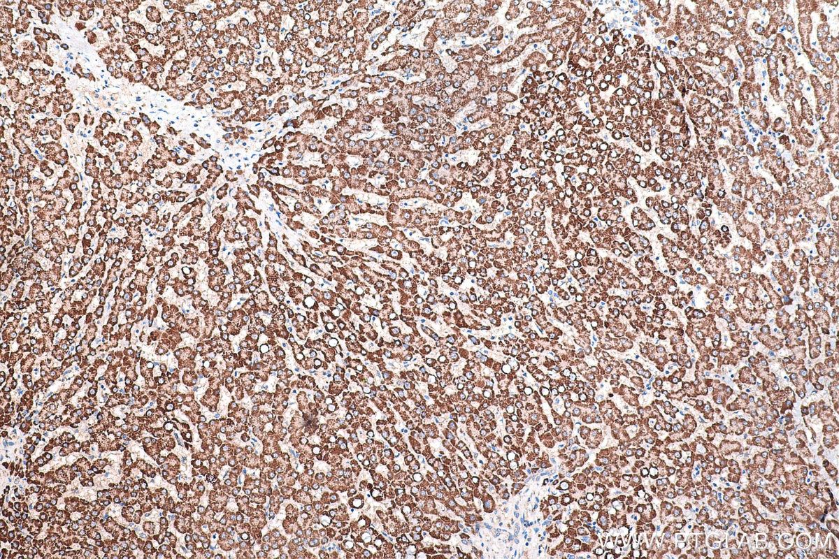 Immunohistochemical analysis of paraffin-embedded human liver tissue slide using KHC0447 (PPIF IHC Kit).