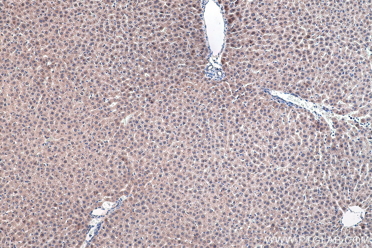 Immunohistochemical analysis of paraffin-embedded rat liver tissue slide using KHC0447 (PPIF IHC Kit).