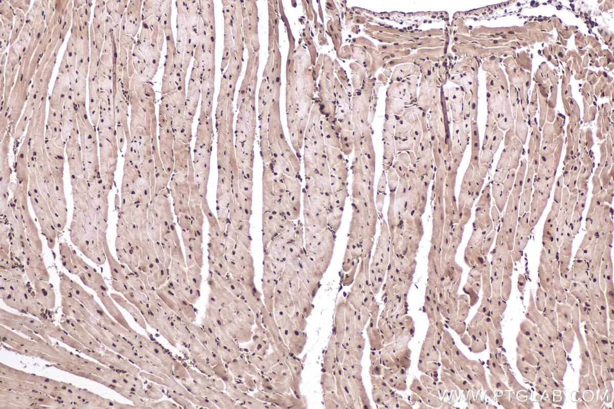 Immunohistochemical analysis of paraffin-embedded mouse heart tissue slide using KHC0836 (PPIL1 IHC Kit).