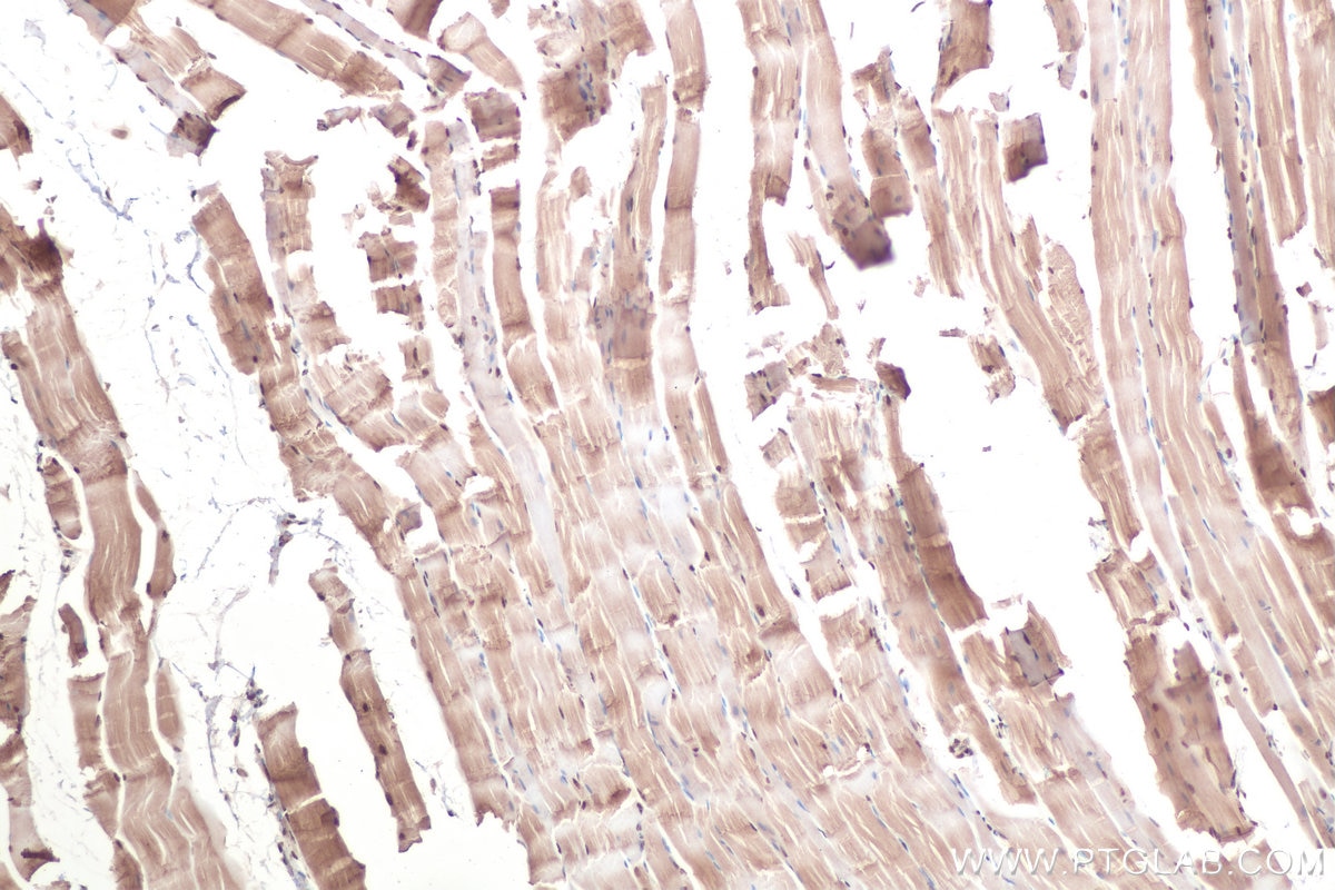 Immunohistochemical analysis of paraffin-embedded rat skeletal muscle tissue slide using KHC0836 (PPIL1 IHC Kit).