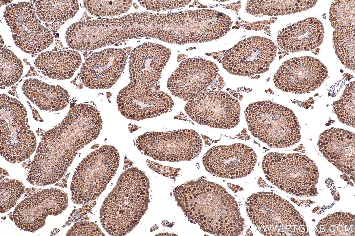 Immunohistochemical analysis of paraffin-embedded mouse testis tissue slide using KHC0837 (PPIL3 IHC Kit).