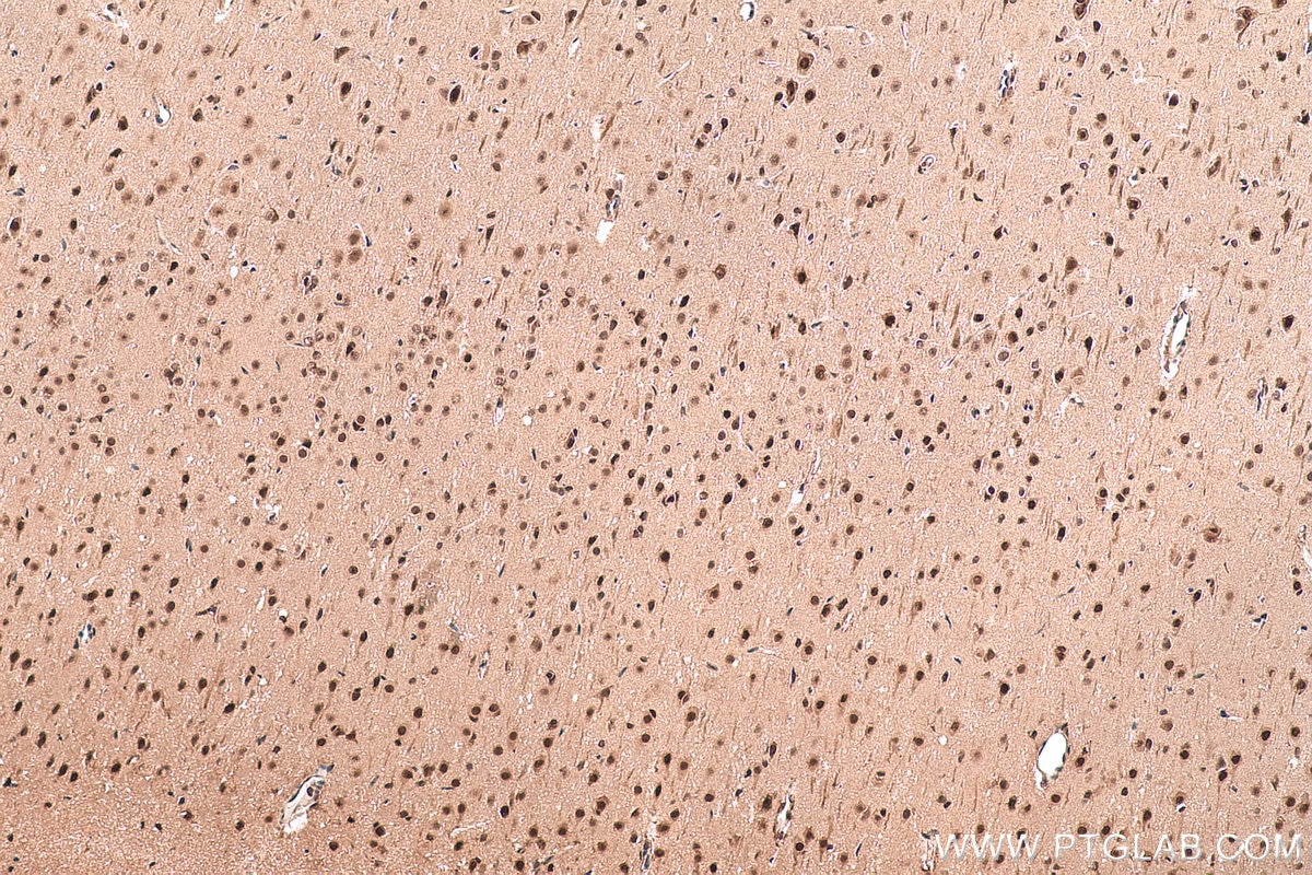 Immunohistochemical analysis of paraffin-embedded rat brain tissue slide using KHC0837 (PPIL3 IHC Kit).