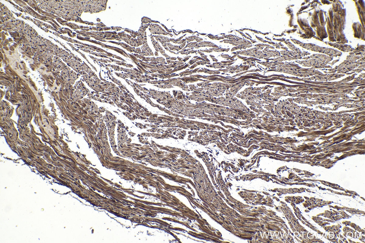 Immunohistochemical analysis of paraffin-embedded mouse heart tissue slide using KHC1586 (PPM1A IHC Kit).