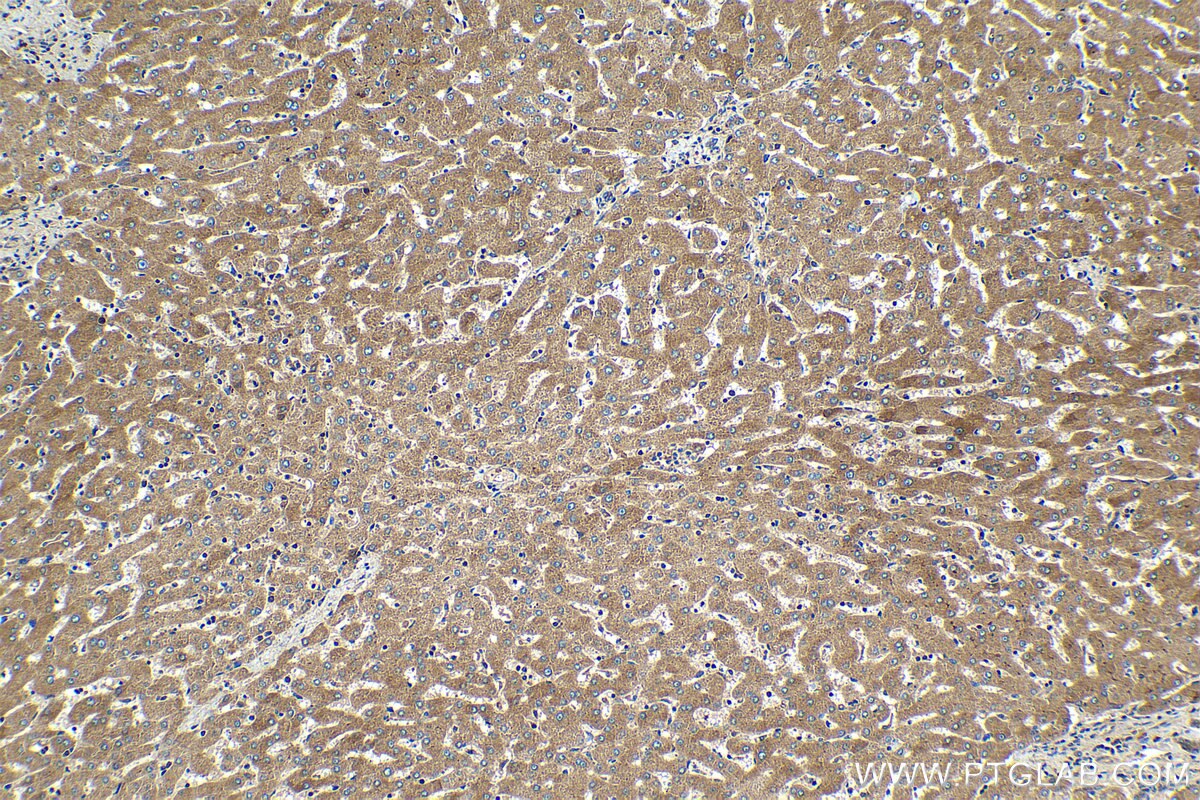 Immunohistochemical analysis of paraffin-embedded human liver tissue slide using KHC2070 (PPM1D IHC Kit).