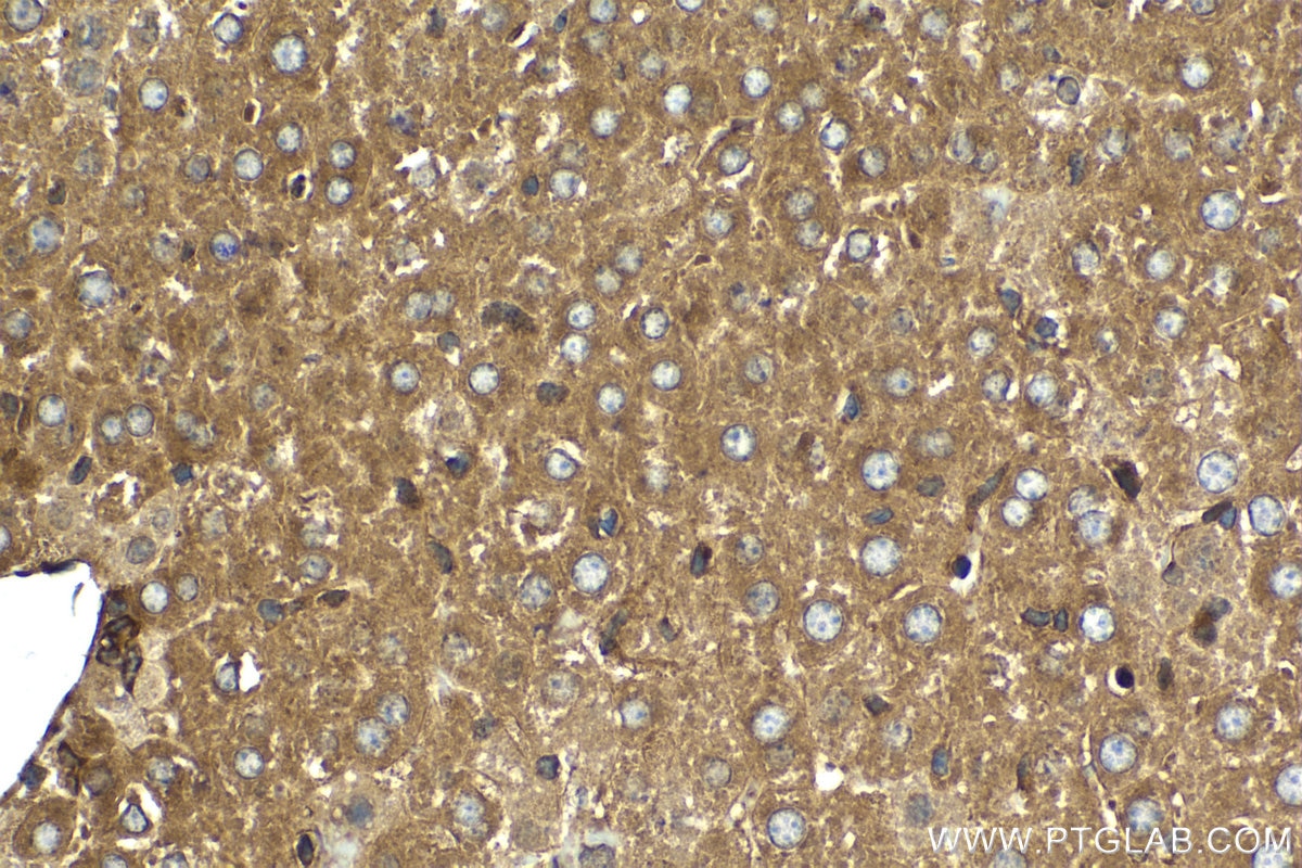 Immunohistochemical analysis of paraffin-embedded mouse liver tissue slide using KHC2070 (PPM1D IHC Kit).