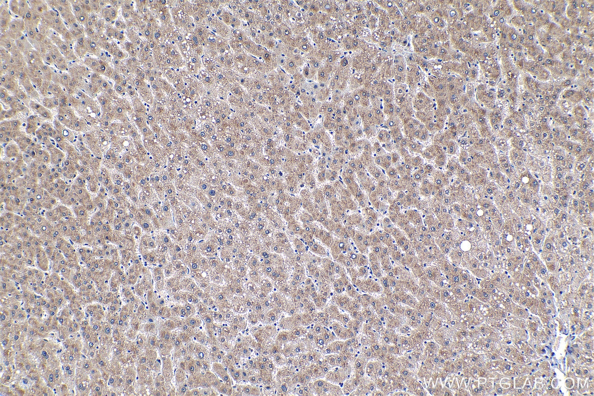 Immunohistochemical analysis of paraffin-embedded human liver tissue slide using KHC1302 (PPM1G IHC Kit).