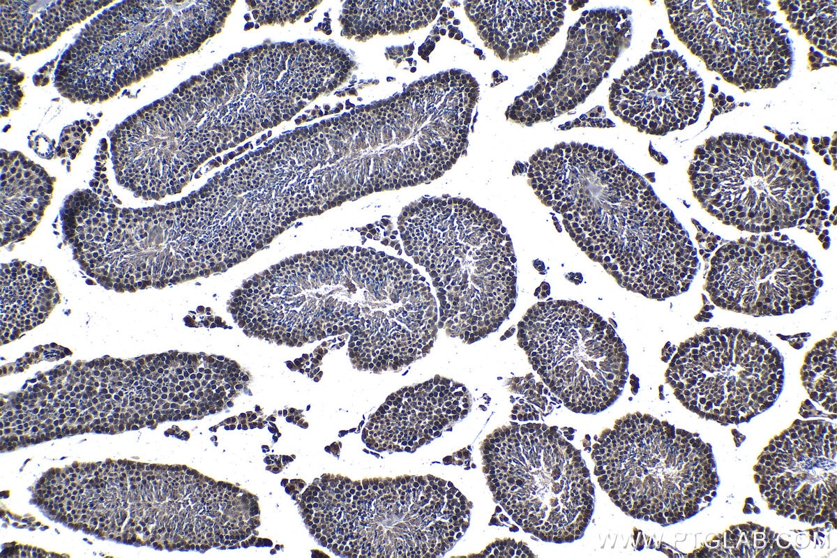 Immunohistochemical analysis of paraffin-embedded mouse testis tissue slide using KHC1302 (PPM1G IHC Kit).
