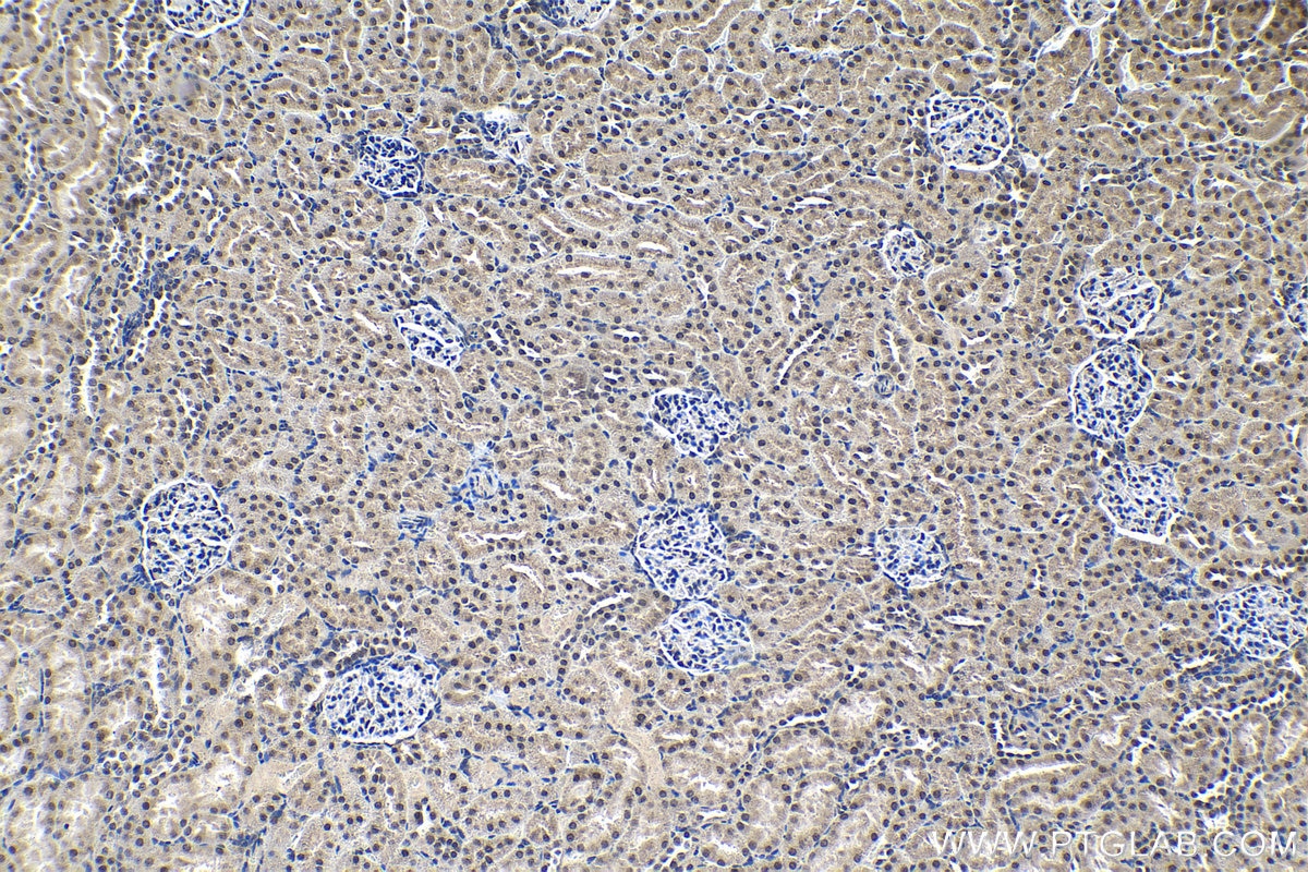 Immunohistochemical analysis of paraffin-embedded rat kidney tissue slide using KHC1302 (PPM1G IHC Kit).