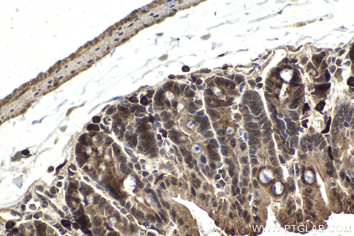 Immunohistochemical analysis of paraffin-embedded mouse small intestine tissue slide using KHC2035 (PPP1CA IHC Kit).