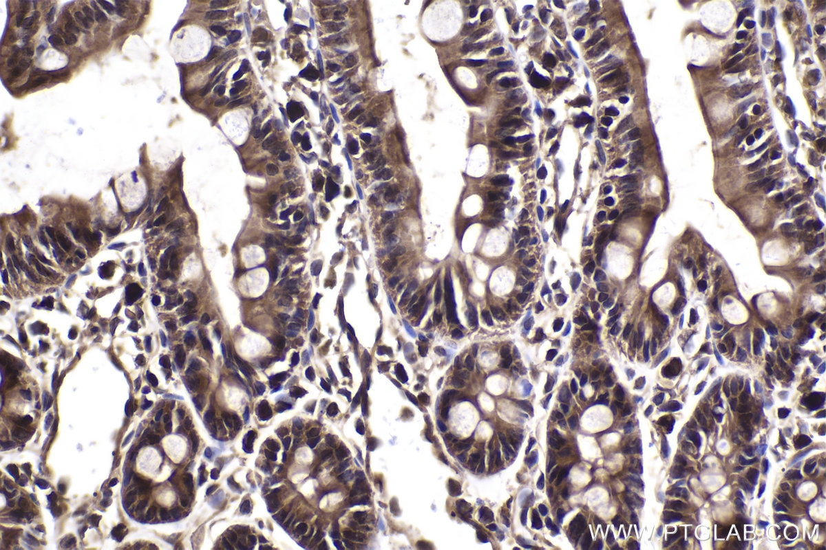 Immunohistochemical analysis of paraffin-embedded rat small intestine tissue slide using KHC2035 (PPP1CA IHC Kit).
