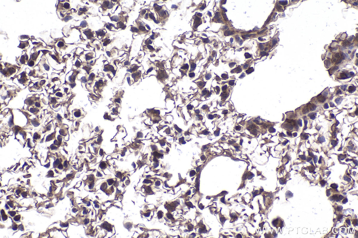 Immunohistochemical analysis of paraffin-embedded mouse lung tissue slide using KHC2035 (PPP1CA IHC Kit).