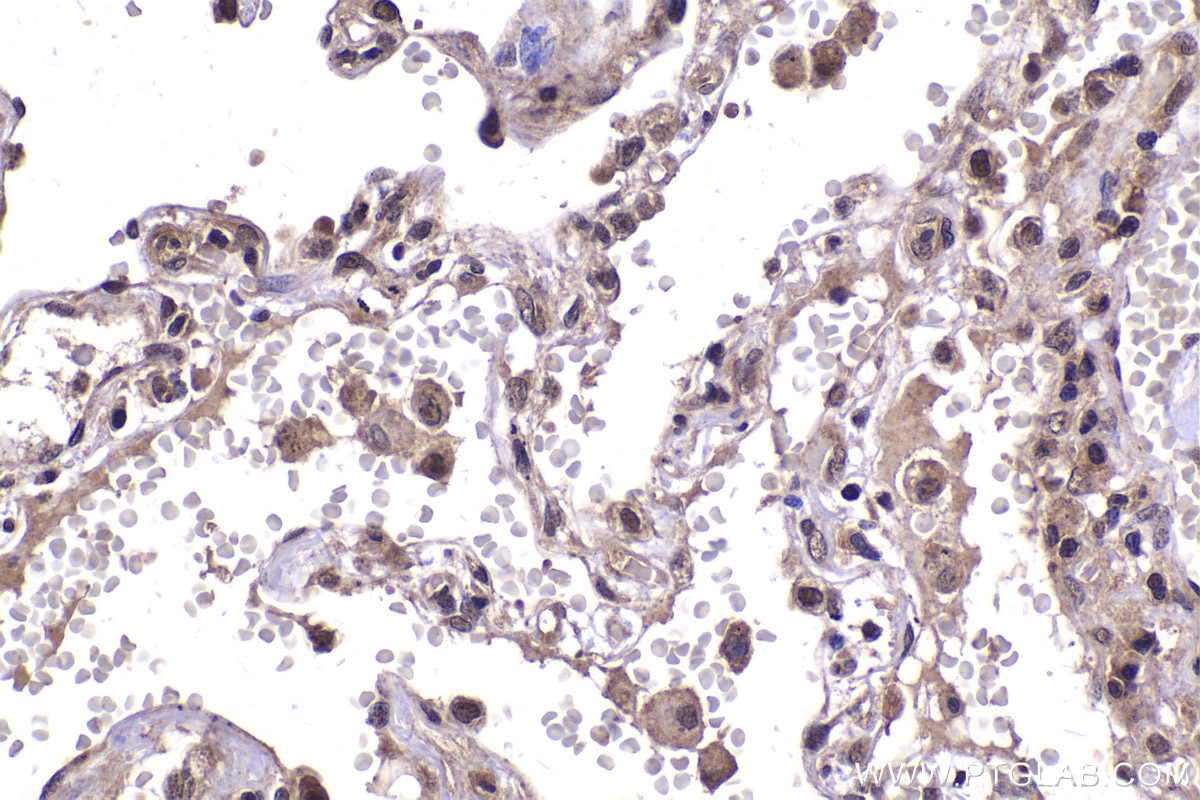 Immunohistochemical analysis of paraffin-embedded human lung tissue slide using KHC2035 (PPP1CA IHC Kit).