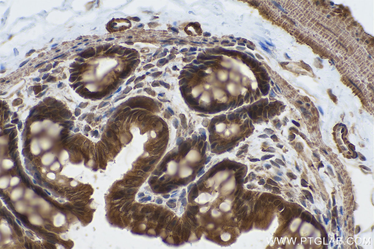 Immunohistochemical analysis of paraffin-embedded rat colon tissue slide using KHC0850 (PPP1CB IHC Kit).