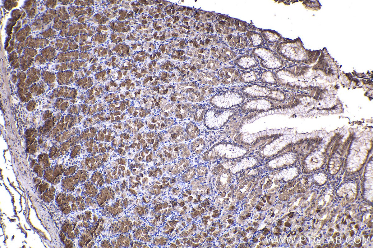 Immunohistochemical analysis of paraffin-embedded human stomach tissue slide using KHC2254 (PPP1CC IHC Kit).