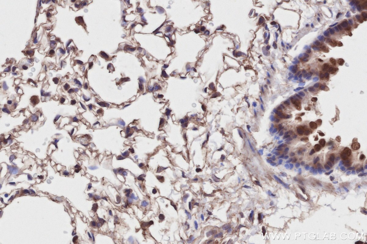 Immunohistochemical analysis of paraffin-embedded rat lung tissue slide using KHC2805 (PPP1R13B IHC Kit).