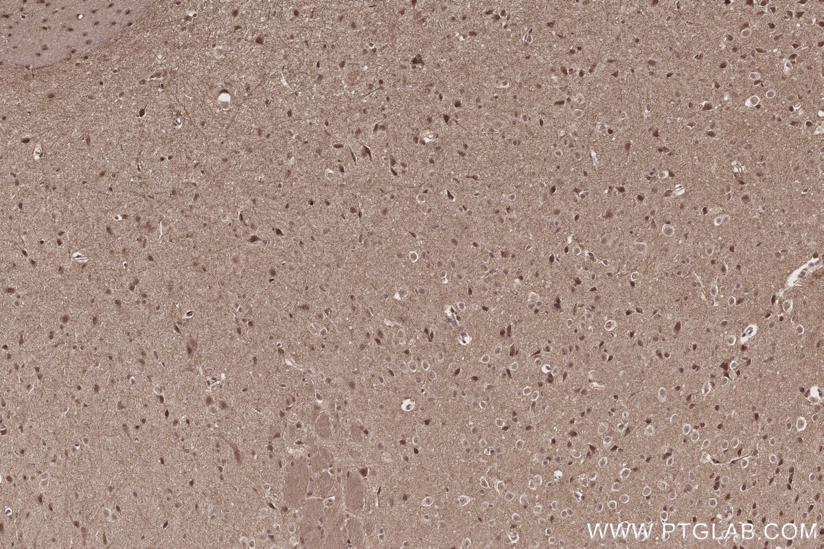 Immunohistochemical analysis of paraffin-embedded mouse brain tissue slide using KHC2805 (PPP1R13B IHC Kit).