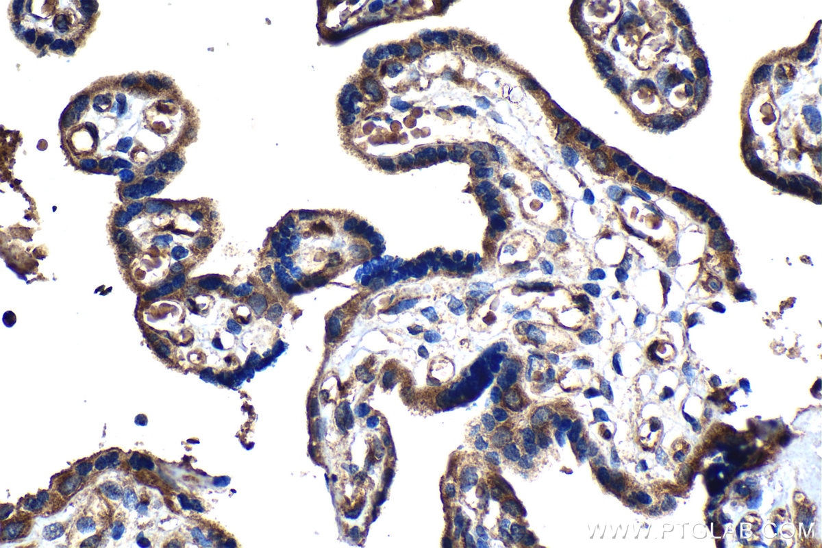 Immunohistochemical analysis of paraffin-embedded human placenta tissue slide using KHC1281 (PPP1R13L IHC Kit).