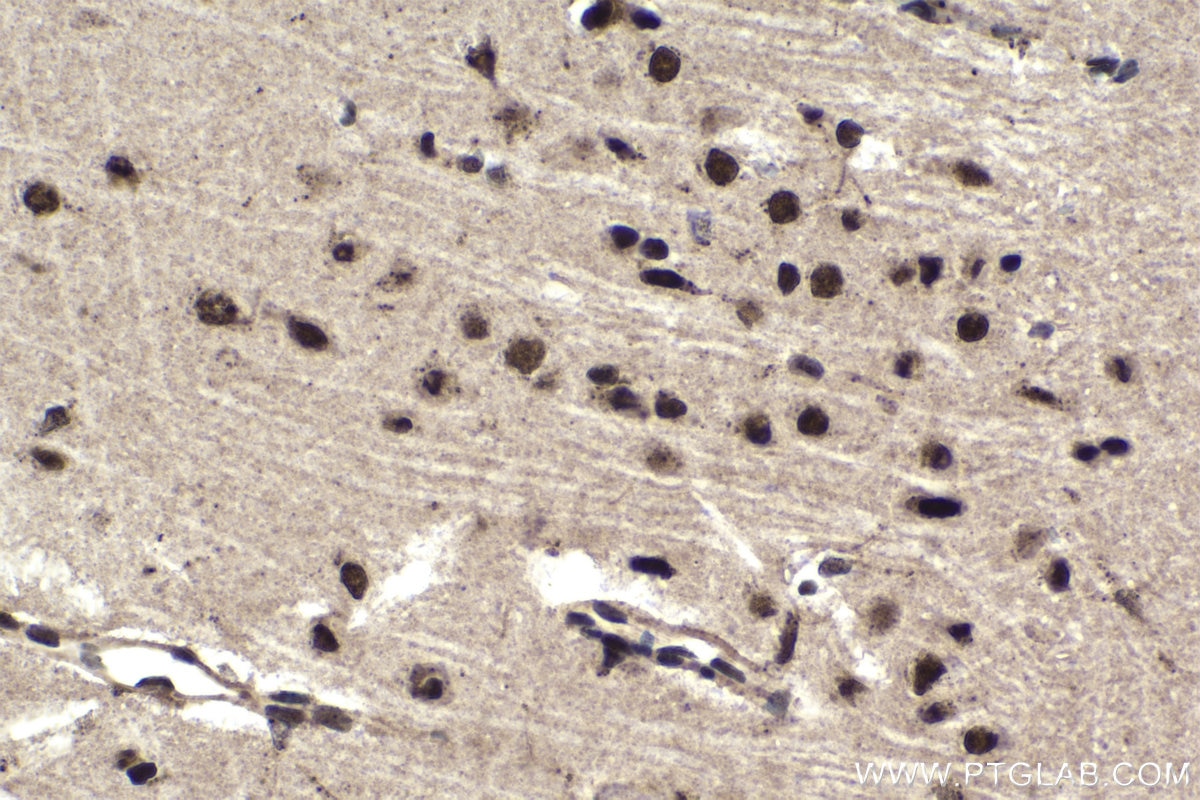 Immunohistochemical analysis of paraffin-embedded rat brain tissue slide using KHC1697 (PPP1R8 IHC Kit).