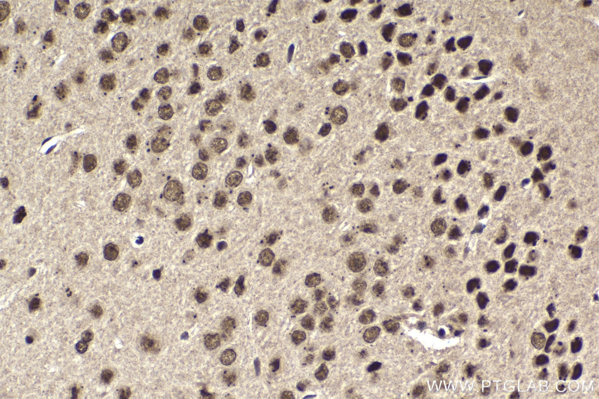 Immunohistochemical analysis of paraffin-embedded mouse brain tissue slide using KHC1697 (PPP1R8 IHC Kit).