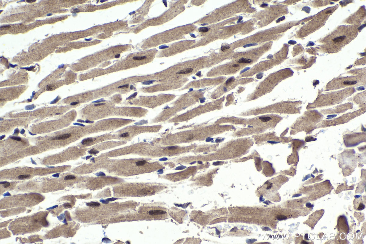 Immunohistochemical analysis of paraffin-embedded mouse heart tissue slide using KHC1697 (PPP1R8 IHC Kit).