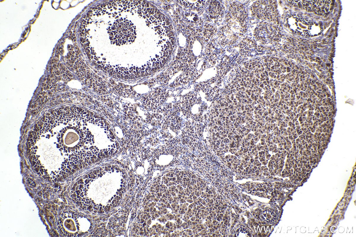 Immunohistochemical analysis of paraffin-embedded mouse ovary tissue slide using KHC2226 (PPP2R1A IHC Kit).