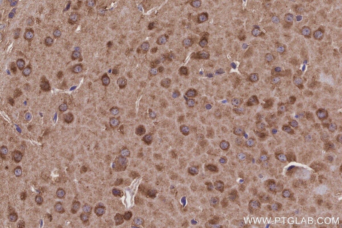 Immunohistochemical analysis of paraffin-embedded mouse brain tissue slide using KHC3246 (PPP2R2B IHC Kit).