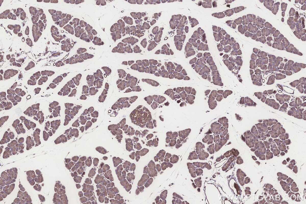 Immunohistochemical analysis of paraffin-embedded rat pancreas tissue slide using KHC3246 (PPP2R2B IHC Kit).