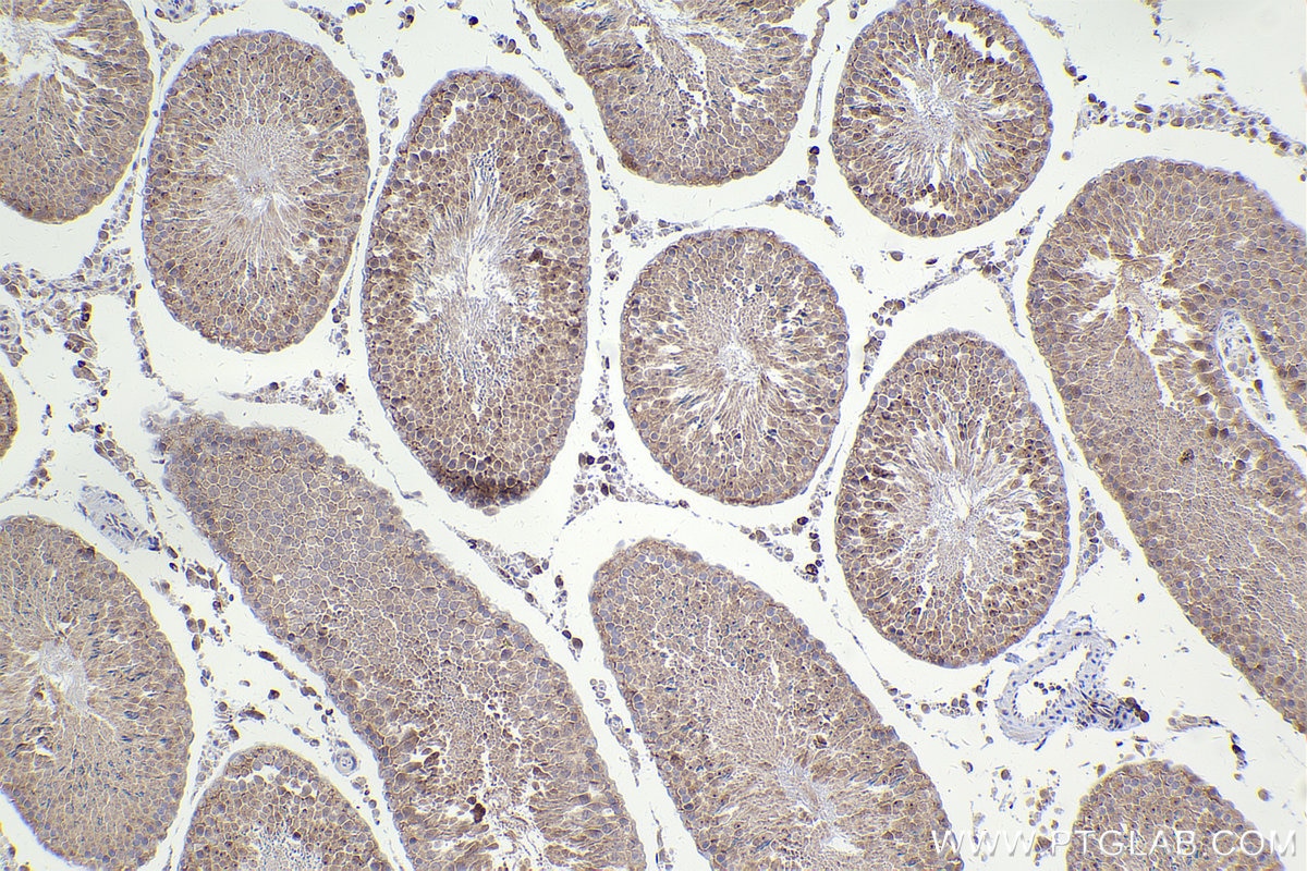 Immunohistochemical analysis of paraffin-embedded rat testis tissue slide using KHC2425 (PPP2R5C IHC Kit).