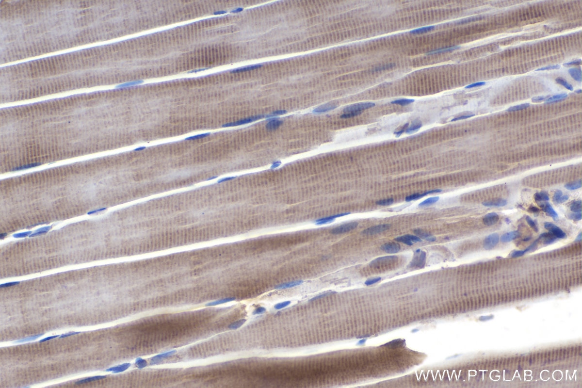 Immunohistochemical analysis of paraffin-embedded rat skeletal muscle tissue slide using KHC1027 (PPP3CA IHC Kit).